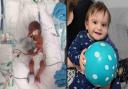 Baby Rohan was born premature and weighing just one pound but is thriving as he celebrated his first birthday.
