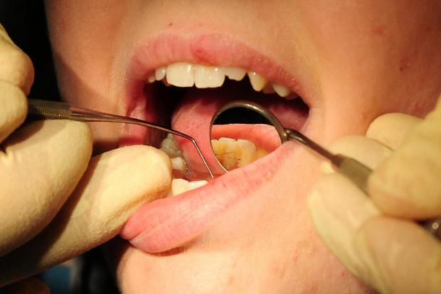 New research sounds the alarm on the state of NHS dentistry. (Picture: PA Wire)